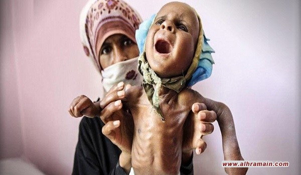 عن مجاعة أطفال اليمن والضمير العربي النائم! 