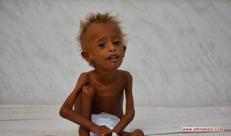 50 ألف طفل يمني معرضون للموت بنهاية 2017 بسبب الحصار السعودي 