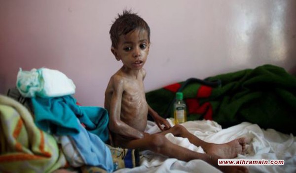 الأمم المتحدة تحذّر من “خطر مجاعة كبير” في اليمن