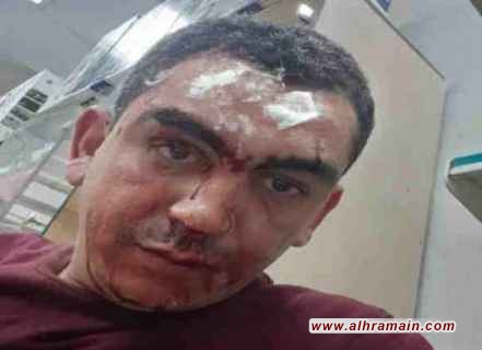 جريمة أخرى ضد المصريين في السعودية.. اعتداء وحشي على طبيب بيطري مصري بالرياض.. ومواقع التواصل تشتعل غضبًا وتضامنًا