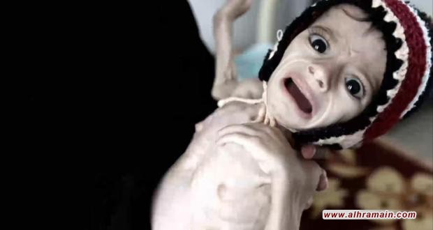 كل بضع دقائق يموت طفل يمني