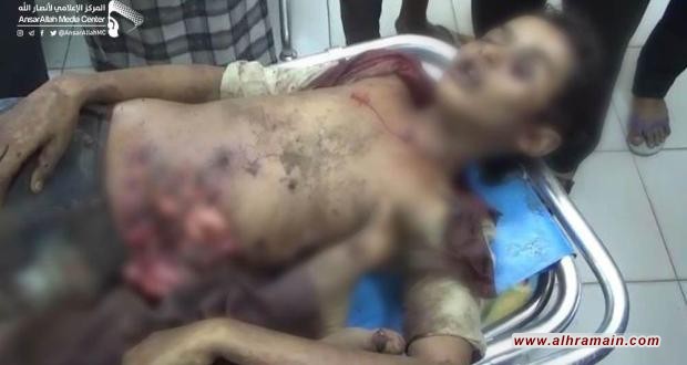 استشهاد 5 أطفال وجرح سادس بانفجار قذيفة من مخلفات العدوان السعودي في الحُديدة