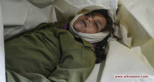 إصابة طفلة بجروح اثر انفجار قنبلة عنقودية من مخلفات العدوان السعودي