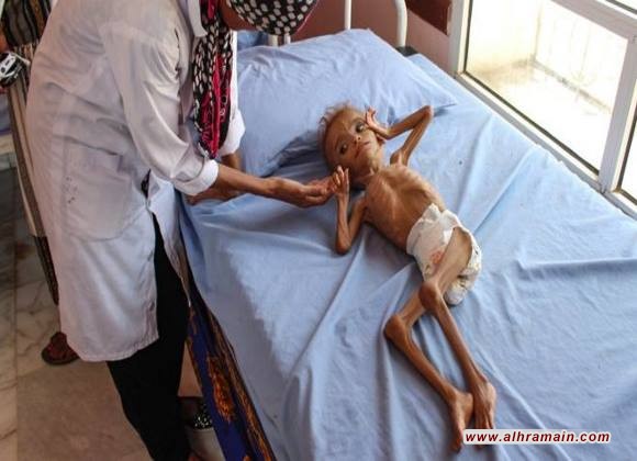 الإندبندنت: مخزون الطعام في اليمن &ldquo;قد ينفد خلال شهرين&rdquo;