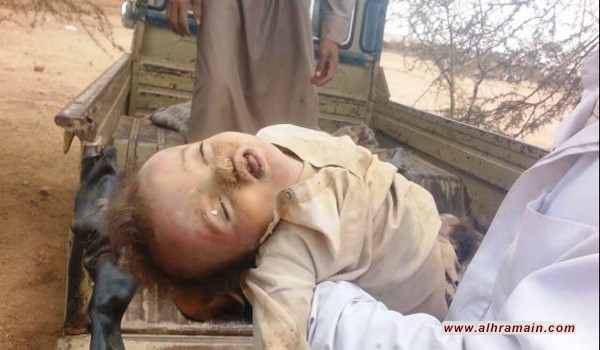 السعودية تعاقدت مع جماعات ضغط وشركات علاقات عامة لتلميع صورتها بشأن اليمن